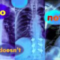 Research exhibits vision-language fashions can’t deal with queries with negation phrases