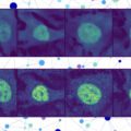 With AI, researchers predict the situation of nearly any protein inside a human cell